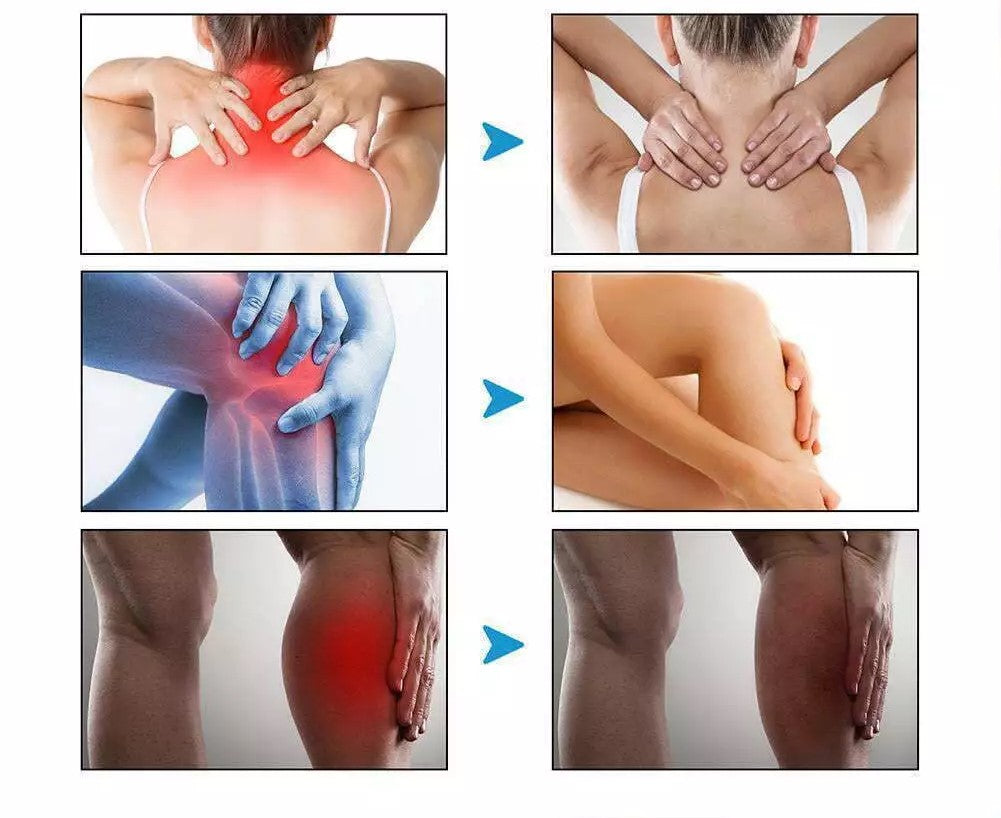 🔥OFERTA PAGA 1 Y LLEVA 2 - Crema de terapia para Artritis, Reumatismo, Dolor de huesos, a base de veneno de abeja Beevana™
