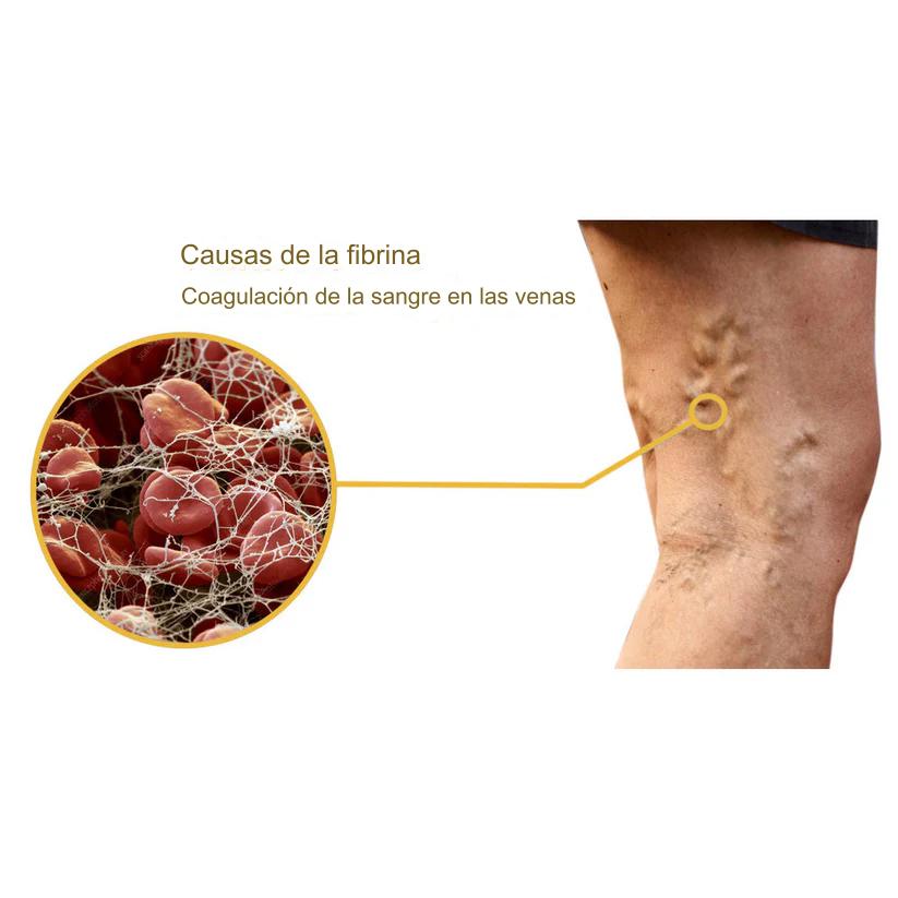 🐝Paga 1 lleva 2 Frascos de Veneno de abeja contra la VARICE + ULCERA + FLEBITIS// BEEVENOM 2X1 🐝 VARICOX VEINⓇ