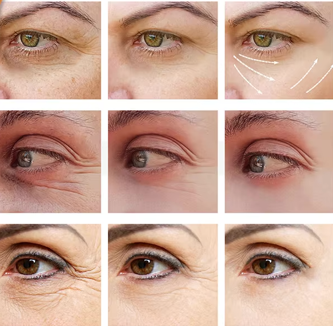 2 X 1 TRATAMIENTO CONTORNO DE OJOS DE VITAMINA C | ORIGINAL
