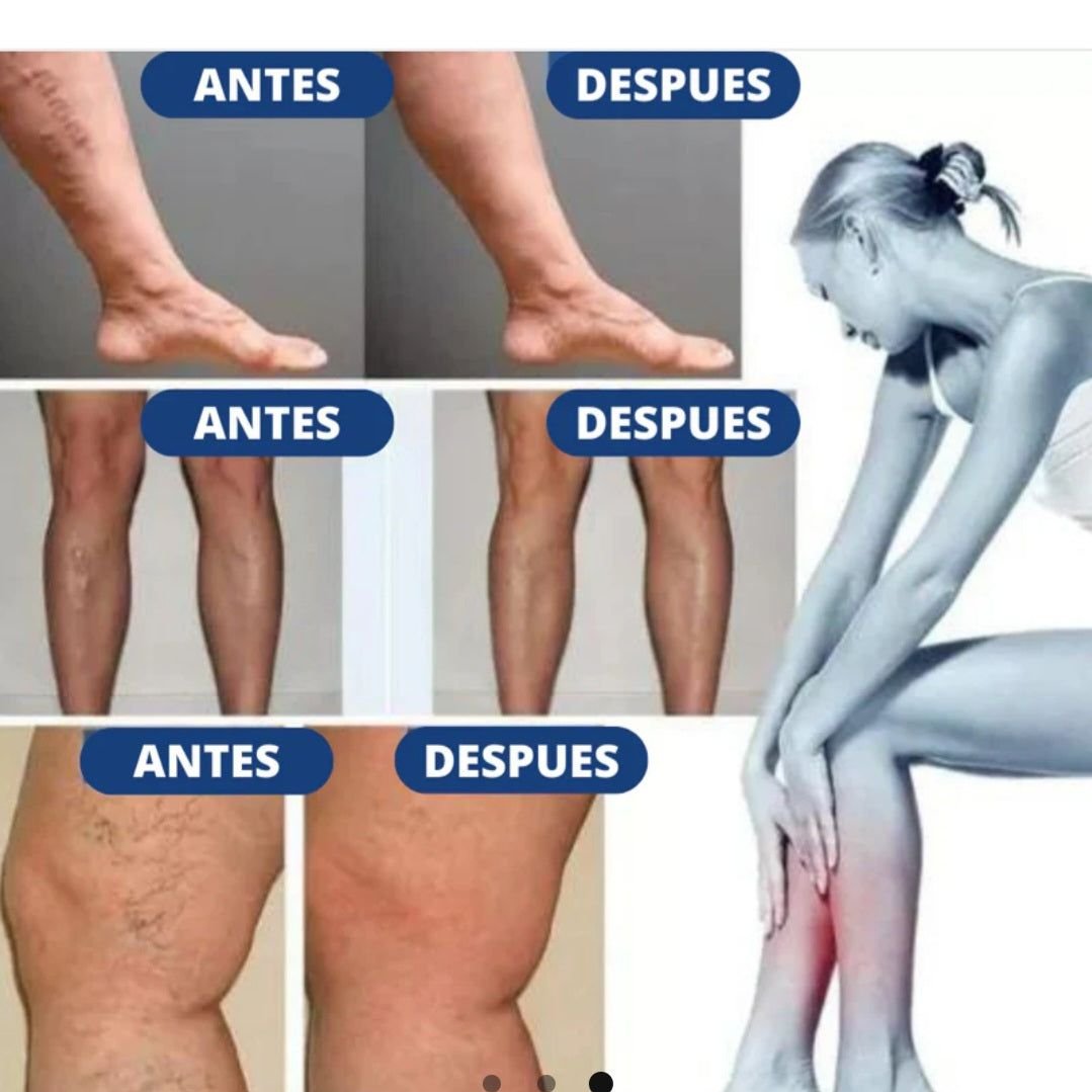 🚨 PROMO 2 X 1 PARCHES X 24 UNDS TRATAMIENTO VENAS VARICES, REDUCEN ULCERA, HINCHAZÓN Y CALAMBRES
