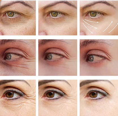 2 X 1 TRATAMIENTO CONTORNO DE OJOS DE VITAMINA C | ORIGINAL