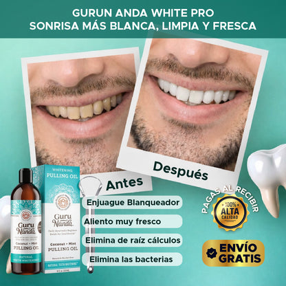 🦷✨💎 GURU NANDA™ 💎✨🦷 EL MEJOR BLANQUEADOR PARA ELIMINAR SARRO Y HALITOSIS