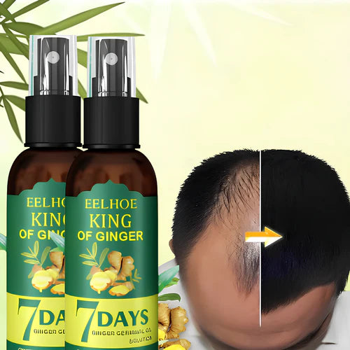 🎁OFERTA PAGA 1 Y LLEVA 2 TRATAMIENTOS CONTRA LA CAIDA,  REGENERA HAIR 👩🏻‍🦰👨🏻‍🦰