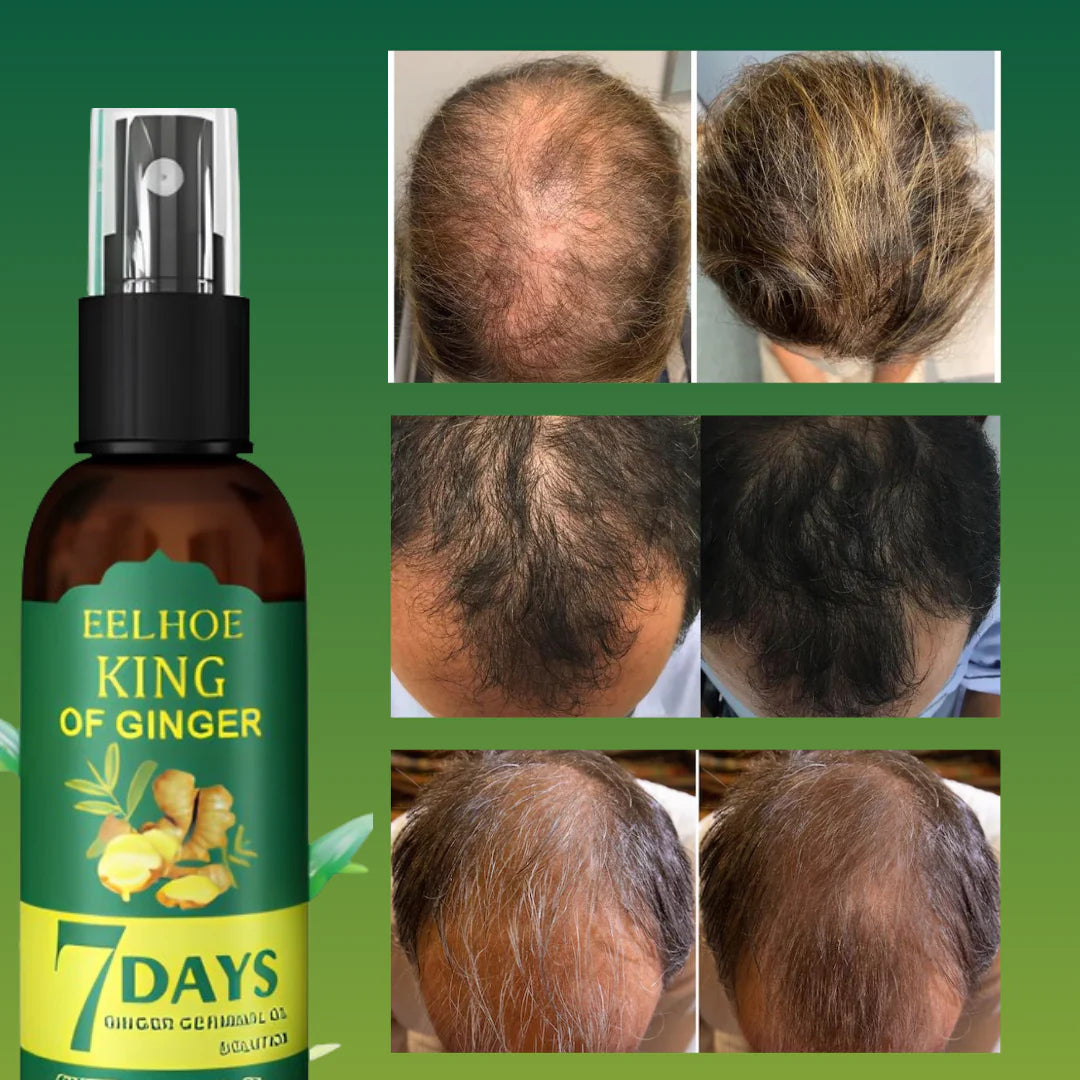 🎁OFERTA PAGA 1 Y LLEVA 2 TRATAMIENTOS CONTRA LA CAIDA,  REGENERA HAIR 👩🏻‍🦰👨🏻‍🦰