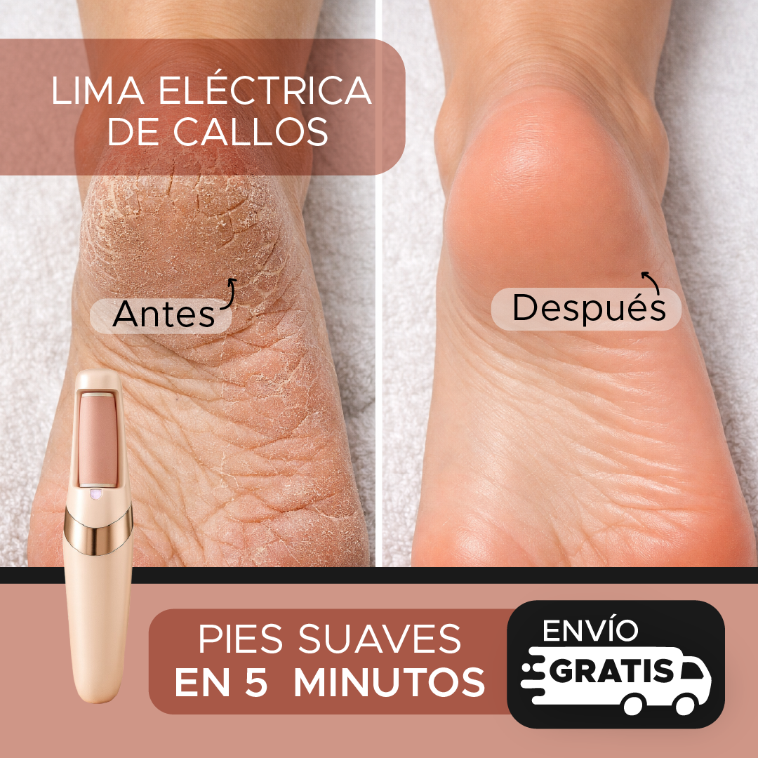 🌸Pedi Spa Set Profesional de Pedicura – Lima Eléctrica inalámbrica + Rodillos Anti durezas💎 Adiós a los talones agrietados
