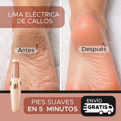 🌸Pedi Spa Set Profesional de Pedicura – Lima Eléctrica inalámbrica + Rodillos Anti durezas💎 Adiós a los talones agrietados