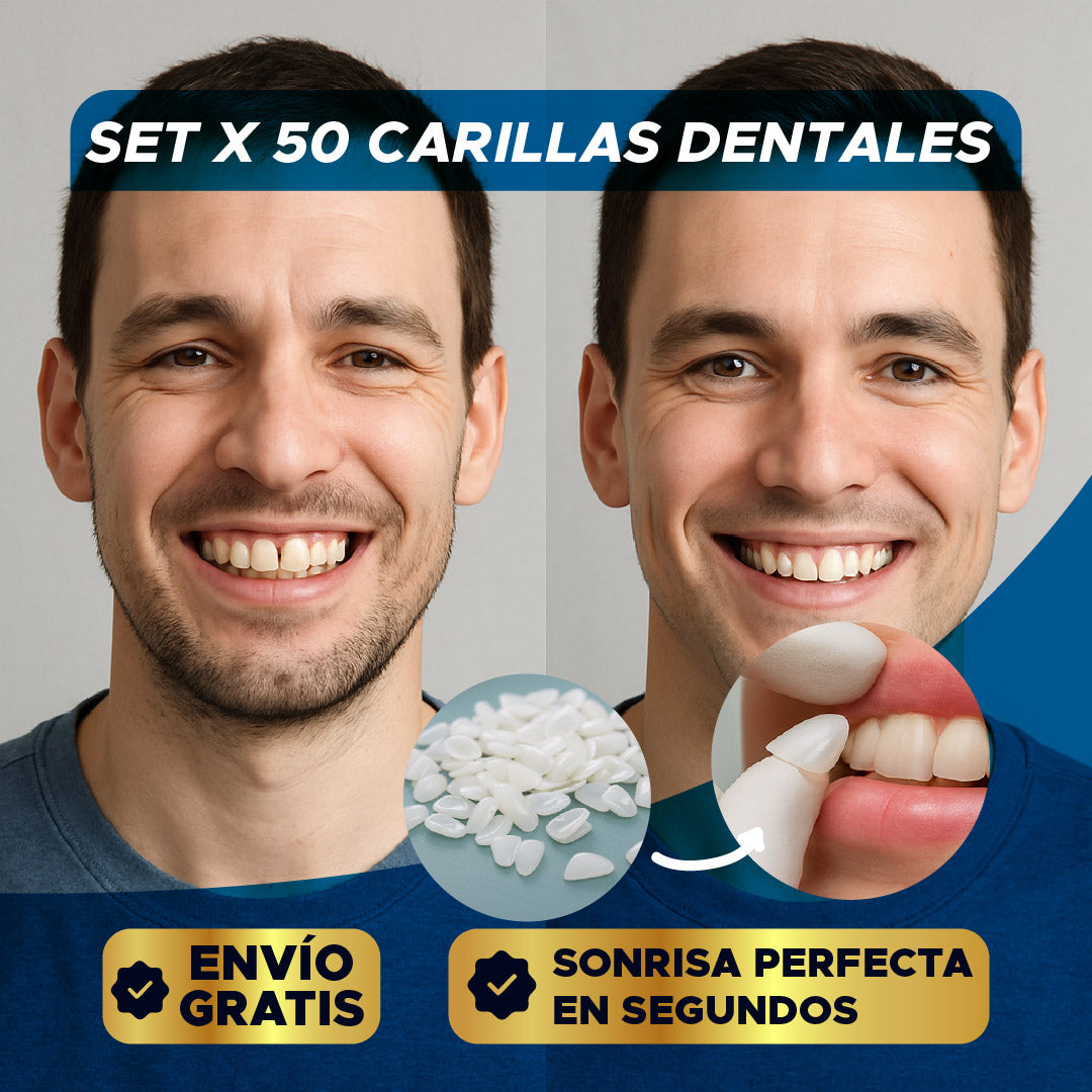✨🦷 SET X 50 CARILLAS DENTALES ⭐😁