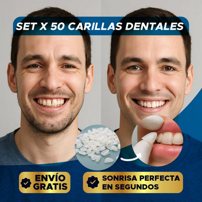 ✨🦷 SET X 50 CARILLAS DENTALES ⭐😁