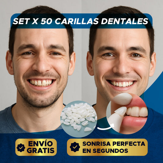 ✨🦷 SET X 50 CARILLAS DENTALES ⭐😁