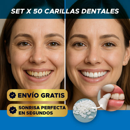 ✨🦷 SET X 50 CARILLAS DENTALES ⭐😁