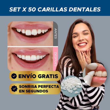 ✨🦷 SET X 50 CARILLAS DENTALES ⭐😁